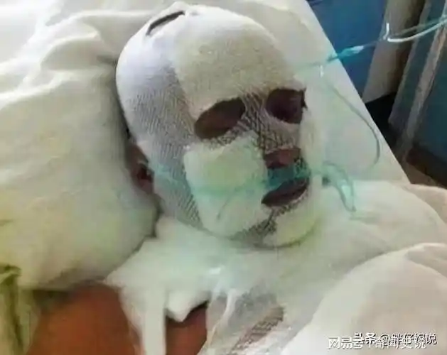 一夜成名,陈少华"耍大牌"被砍掉下巴,缝130针,今卖马桶为生