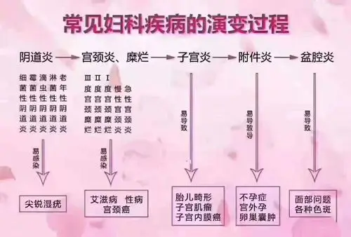 女性生殖健康的重要性