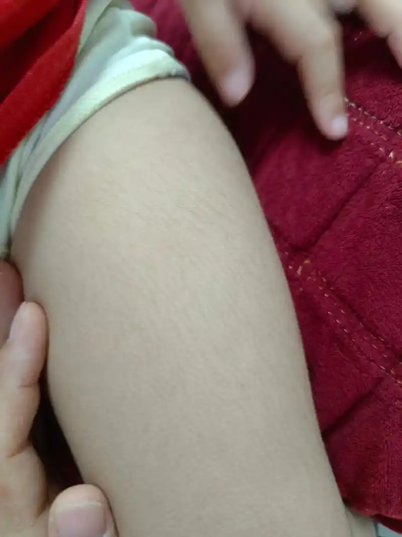 想问问抖音里面的过来人图片是2岁半的腿毛成年后会不会更