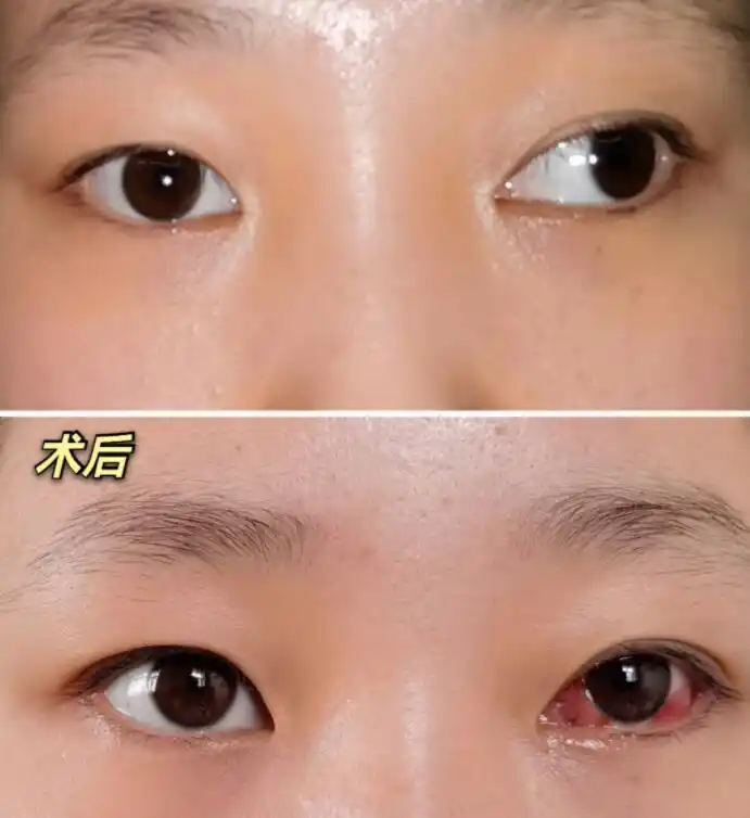 宝宝眼睛斜视怎么办?上海斜视最厉害的医生为您支招!