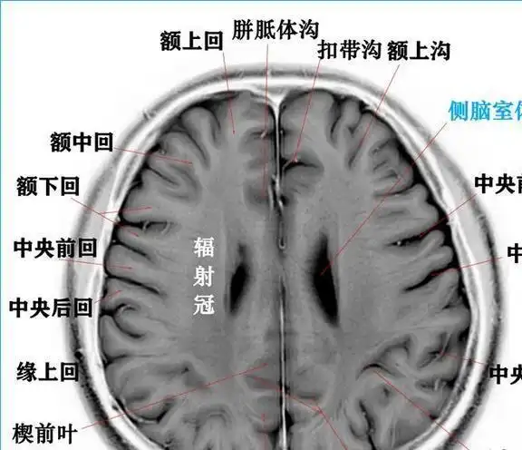 收藏高清颅脑断层解剖图谱