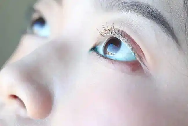 去黄去红血丝28天让眼睛回归婴儿般清澈