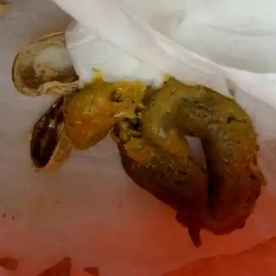 我家闺女五个月二十二天了,添加辅食了,大便要用力拉才拉的出来,这是