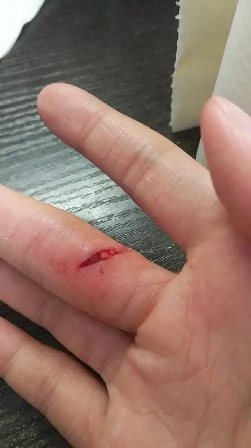 剪东西手不小心被划破了,家里没有消毒水水酒精这种的,怎么办