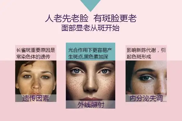 怎么坐月子可以祛掉脸上的黄褐斑 有效的祛斑方法是什么(图)