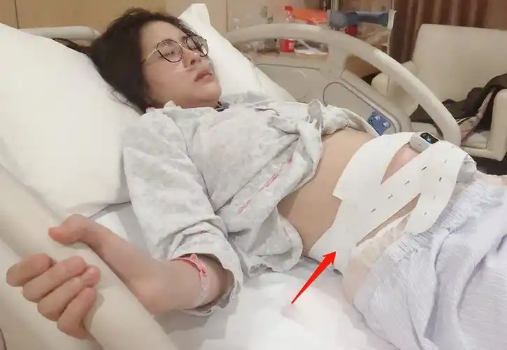 张碧晨"待产照"传出,33周早产孕肚不明显,好友对谣言很无奈