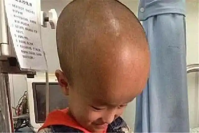 辛勤!大头娃娃奶粉事件原因"白头偕老"-第1张图片-西卡博客