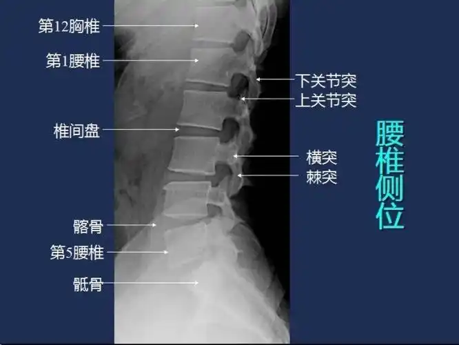 其它 浅谈临床常规dr拍摄体位(三) 写美篇【腰椎摄影】       腰椎