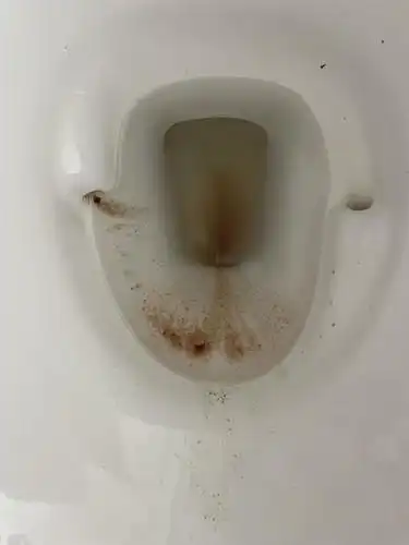 姨妈血是这样是什么情况