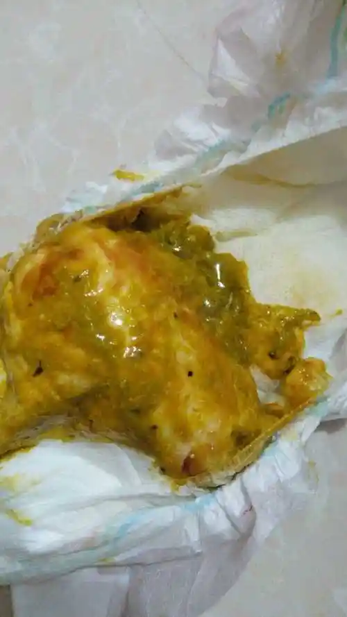 宝宝拉肚子如图.有知道的宝妈吗?急!急