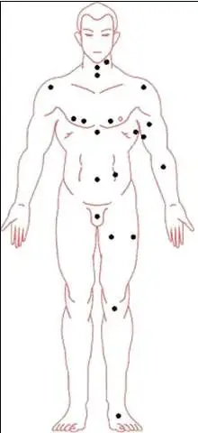 并没相关图解解释,想要了解全身痣相图解,可参考【男人全身痣相图解】