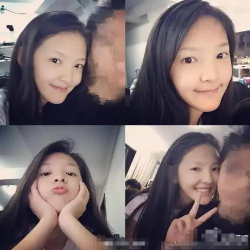 甜美系女神章若楠旧照曝光整没整容一眼就知道