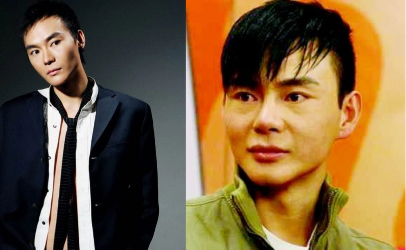 5位承认整过容的男星,图1整容变毁容,图5却是为艺术"献身"