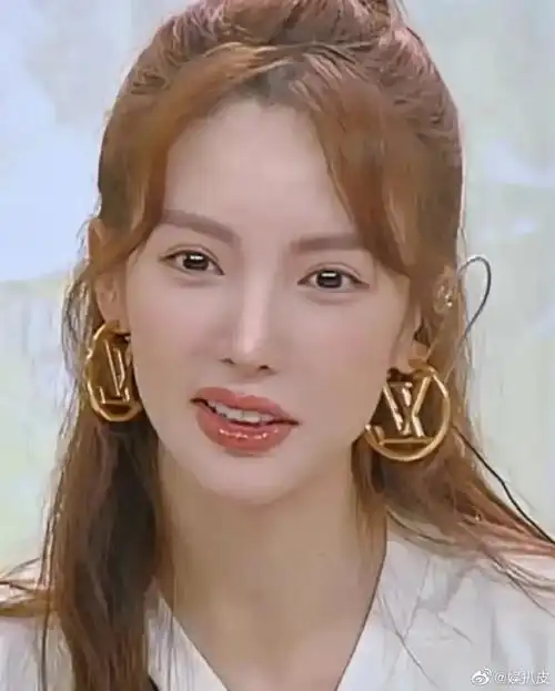 金晨的嘴怎么了