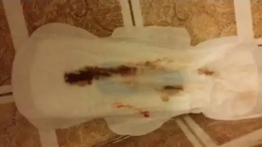 今早上厕所发现纸上有粉色印记,因为月经来也就这两天,但是垫了卫生巾