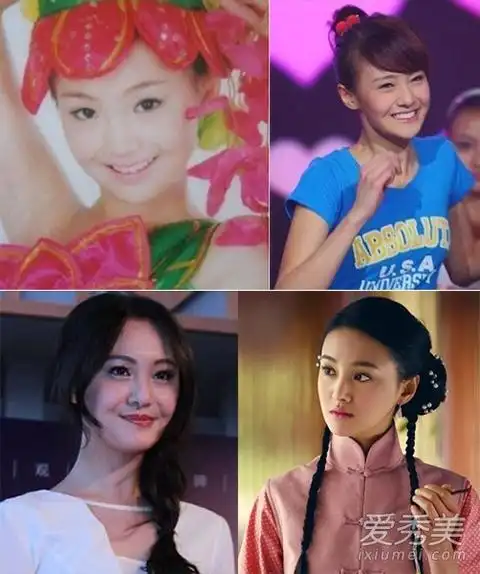 郑爽出道6年容貌变化 整容前后对比照(组图)