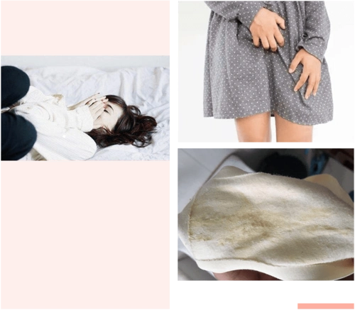 分泌物也有鱼腥味,亲热时男友难以忍受下体奇痒感觉有小虫子在咬内裤