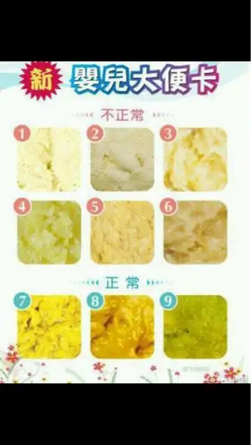 这样颜色得大便正常吗,是陶土色吗,我一个才一次母乳,基本奶粉