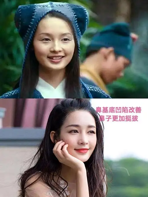 96去年大火的《庆余年》让鸡腿姑娘—李沁深入人心,她_圈子-新氧