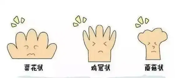 北京和平中西医结合医院专家解读感染了hpv11该怎么办