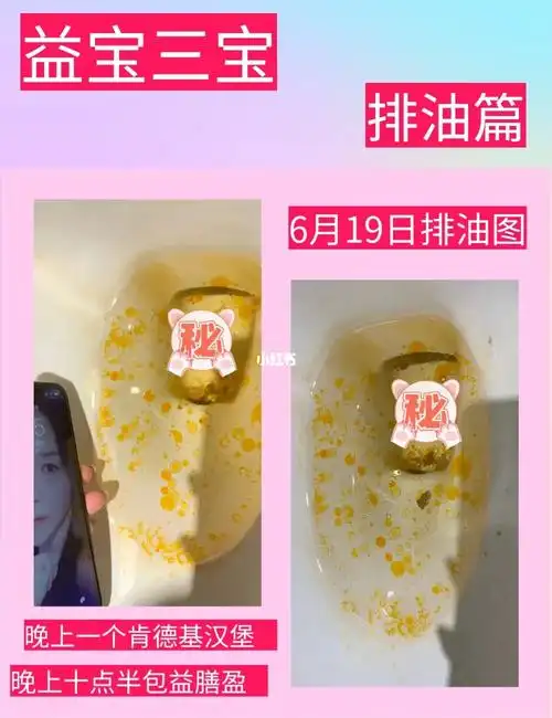 你的内脏脂肪高了吗#減肥