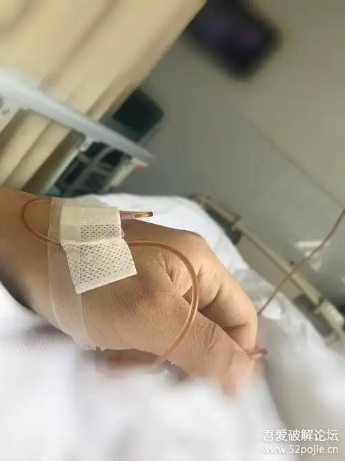 求一张在医院打点滴的男士手部拍照图片(别太胖)哈