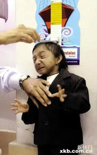 世界最矮男子成年 梦想坐妻子手袋游世界