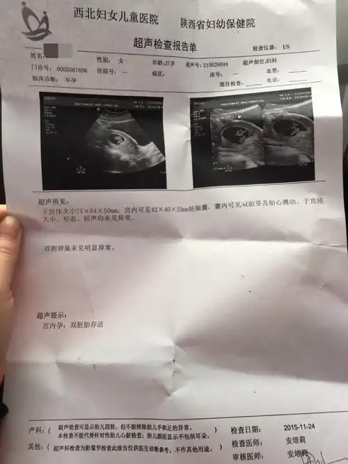 当时40天的时候去检查只有孕囊,无胎心胎芽,把我们担心的,过了3周,去