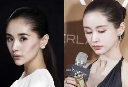 岁月不败美人王子文面部填充的效果真的让人惊艳