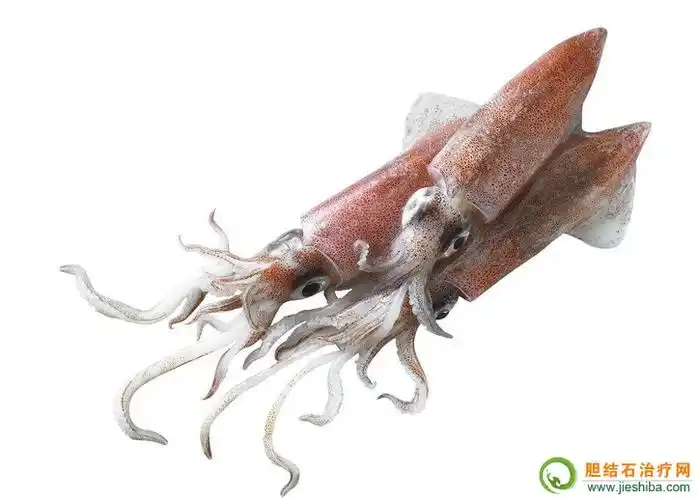 胆结石可以吃乌贼吗