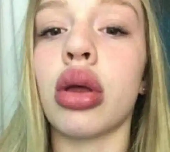 照镜子|公认最丑的3大"唇形",第2种是女生的最爱,直男照照镜子吧