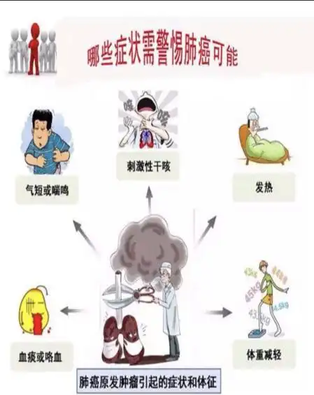 肺癌早期症状有哪些_衡水市中医医院