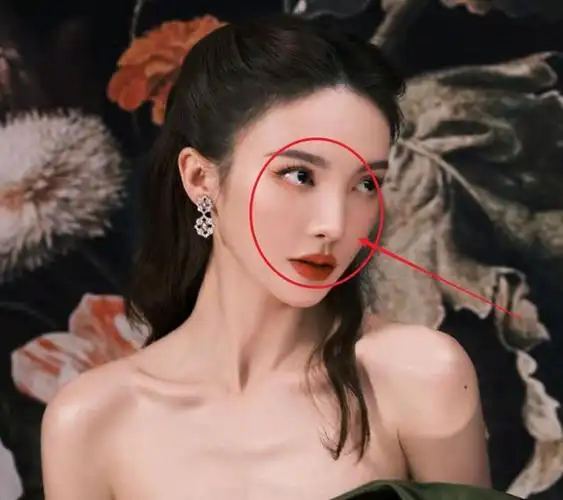 金晨颜值翻车晒视频鼻子太抢眼与旧照对比后被质疑整容