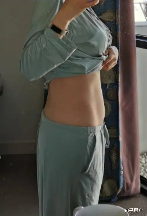 女人生完孩子后肚子的真实状态是怎样的? - 知乎