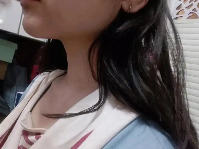 自己得耳垂下方有点痛,摸起来还和右边的不一样,耳垂到下颚长了个硬块