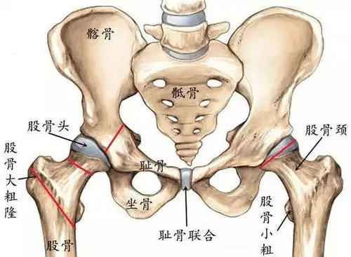 1,髋部或髋周的创伤,如股骨头骨折,股骨颈骨折,髋臼骨折,髋关节脱位和