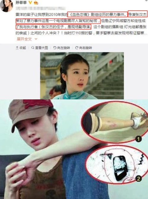 "古装第一美"孙菲菲:整容自毁事业,被剧组暴打,后嫁2婚高管