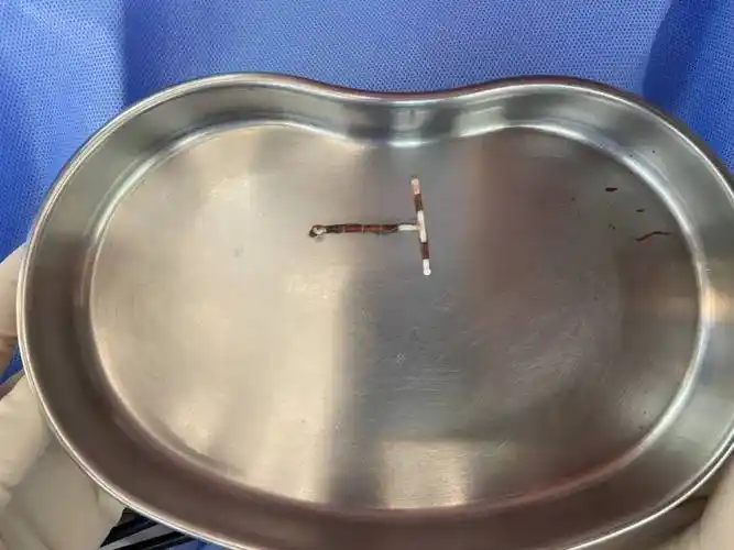 有很多,有国产的"元宫环","t形环","吉妮环"等,还有进口的"曼月乐环"