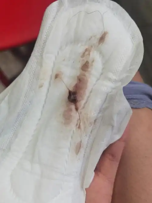 慎有图求助姐妹们排卵前期出现褐色黏稠分泌物少量血谢谢