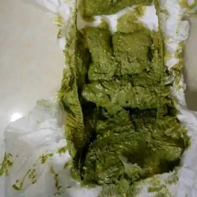 专家 3:正常母乳喂养的婴儿大便偶尔也会呈淡绿色.