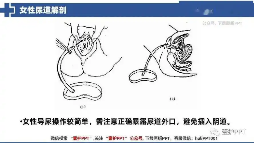 【ppt】那些易被忽视的问题-导尿操作细节解析
