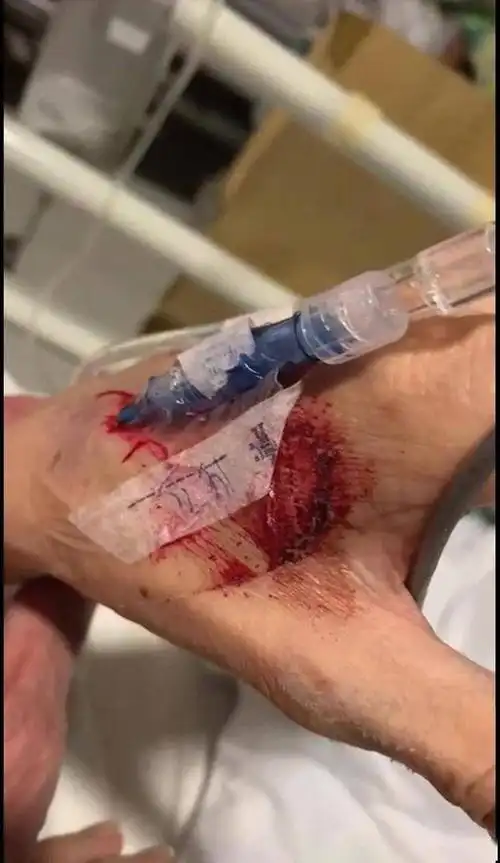 tvb绿叶林利夜闯病房探母痛斥医院妈咪被绑满手是血