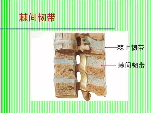 (很有用的)【 棘间韧带 棘上韧带 棘间韧带