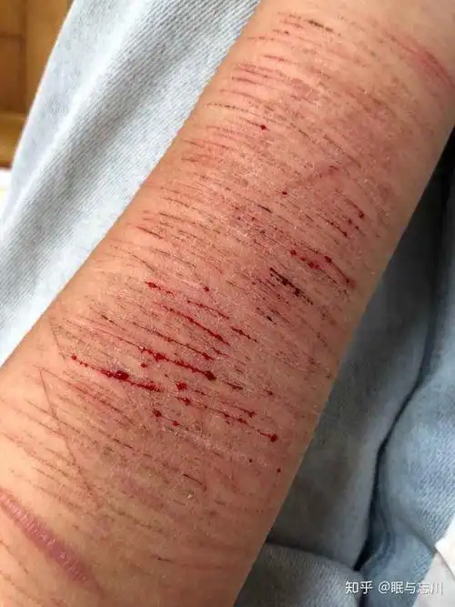 我恨我自己,我喜欢看我自己流血,遇到事情会情绪冲动,自残很爽