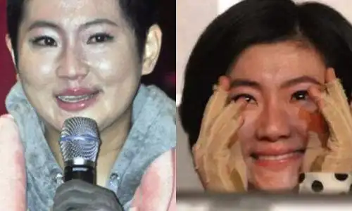 任家萱烧伤事件的原因是什么selina烧伤前后对比照揭秘