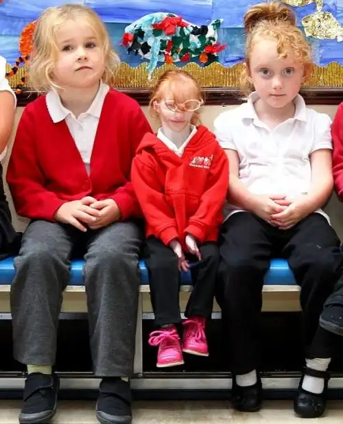 「全球最迷你」小女孩罹患 原基性侏儒症 | 夏洛特加赛德(charlotte