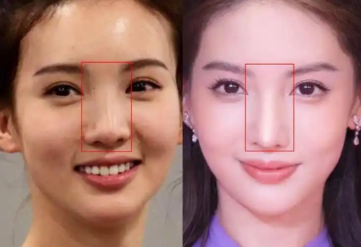 金晨"变脸"争议再起!浪姐翻红,被曝整容与情史