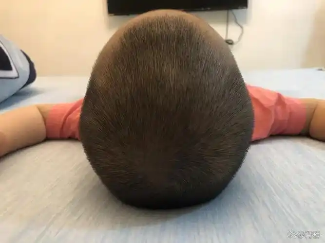 宝宝头型不好看要怎么纠正?宝宝正确睡圆头的方法 - 孕育群