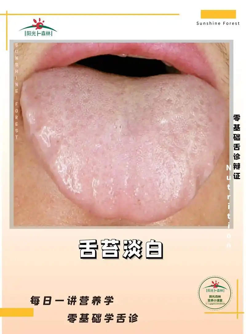 如果舌质很白,白到跟舌苔是一个颜色,感觉就好像是舌 - 抖音