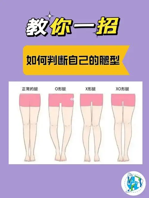 科普‖一招学会 判断腿型,get到了吗?